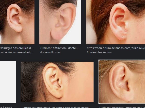Des images d'oreilles de différents individus..